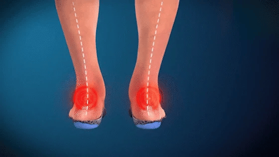 Sandálias femininas ortopédicas sandálias de verão com tiras para caminhada