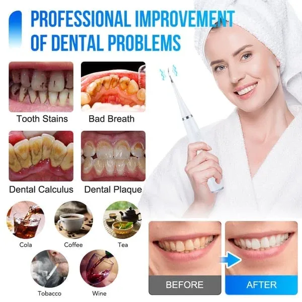 (🔥Spring Promotion 48% OFF) Electric tooth cleaning instrument -Teeth Cleaner-Festivesl