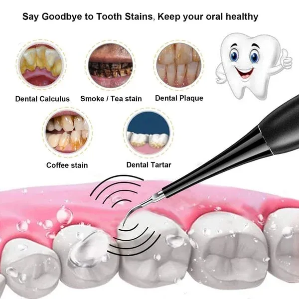 (🔥Spring Promotion 48% OFF) Electric tooth cleaning instrument -Teeth Cleaner-Festivesl