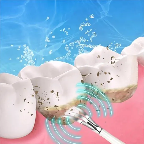 (🔥Spring Promotion 48% OFF) Electric tooth cleaning instrument -Teeth Cleaner-Festivesl