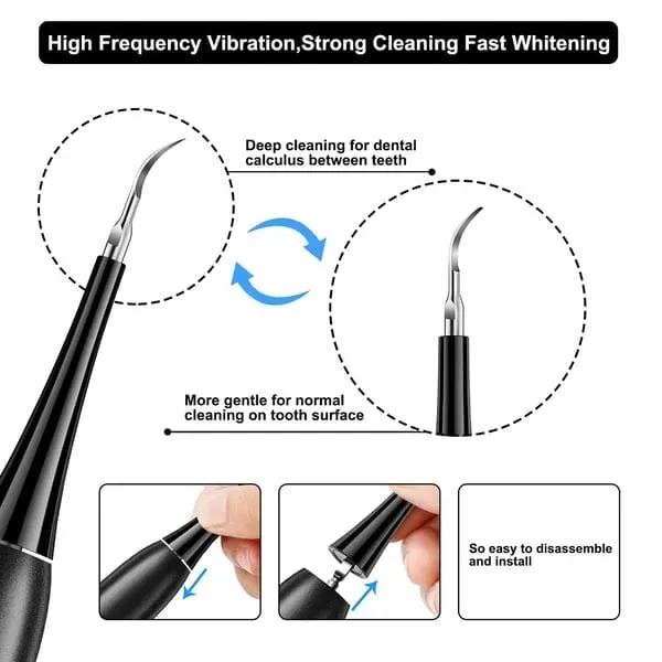 (🔥Spring Promotion 48% OFF) Electric tooth cleaning instrument -Teeth Cleaner-Festivesl