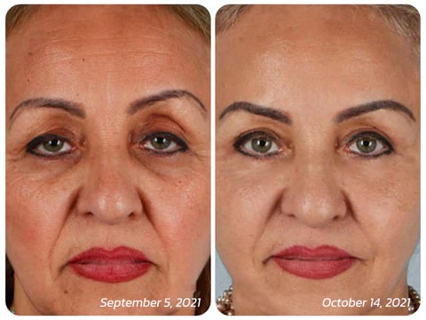 Crocodile Oil Healing & Repairing Eye Cream