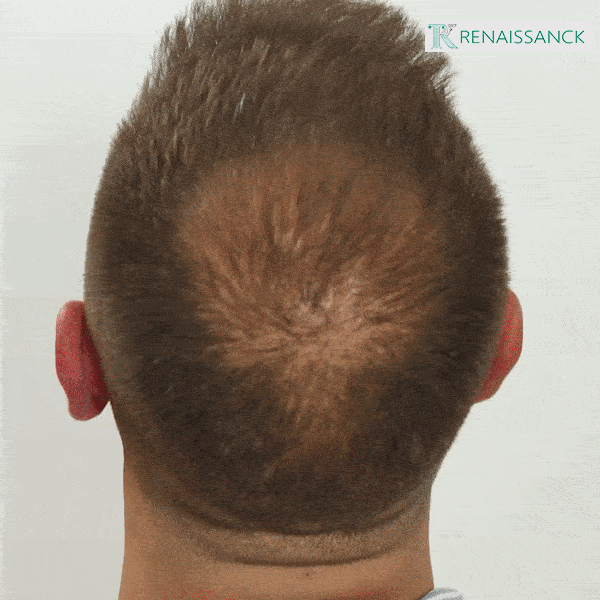 🔥HOT SAVE 49% OFF🔥HAIR FIBERS BUNDLE