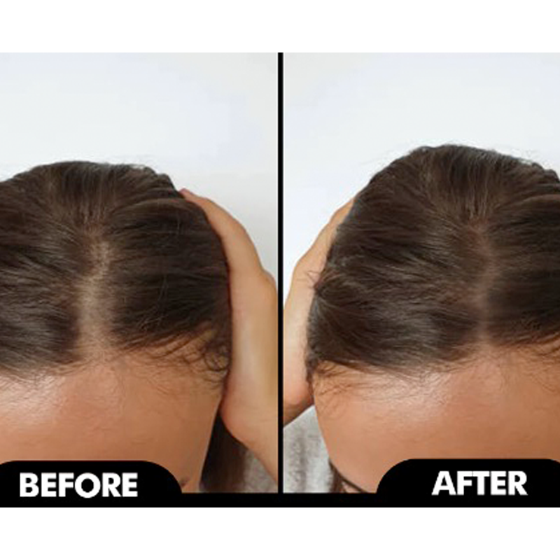 HAIR GROWTH OIL  [Pack of 2]