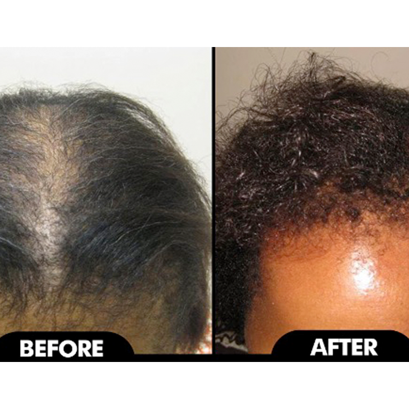 HAIR GROWTH OIL
