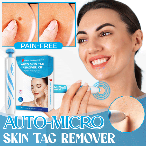 [Copy]Auto Micro Skin Tag Remover