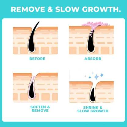 🔥Last Day Promotion 55% OFF -Peach Fuzz Hair Cream