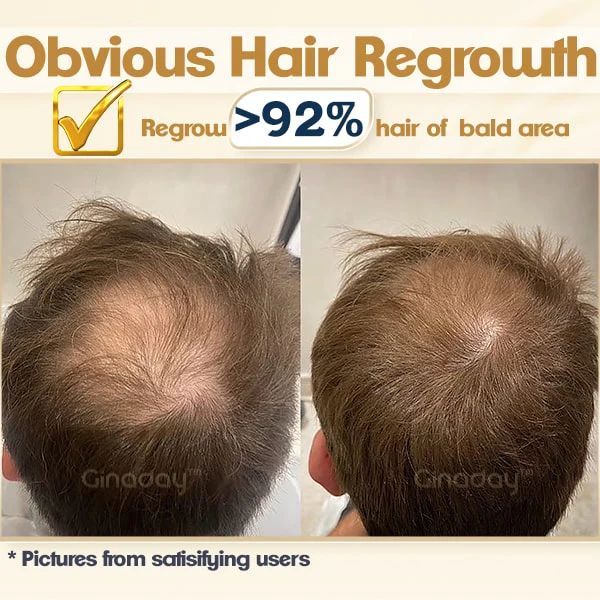 Instant Ginger Hair Regrowth Shampoo