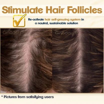 Instant Ginger Hair Regrowth Shampoo