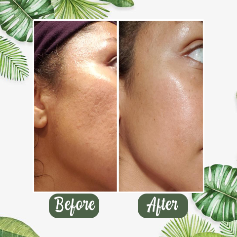 [Copy]Deep Cleanse Green Tea Mask