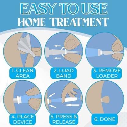 [Copy]Auto Micro Skin Tag Remover