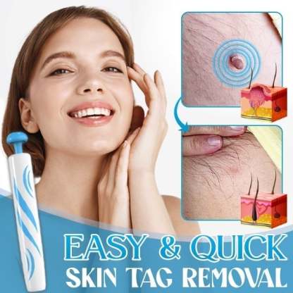 [Copy]Auto Micro Skin Tag Remover