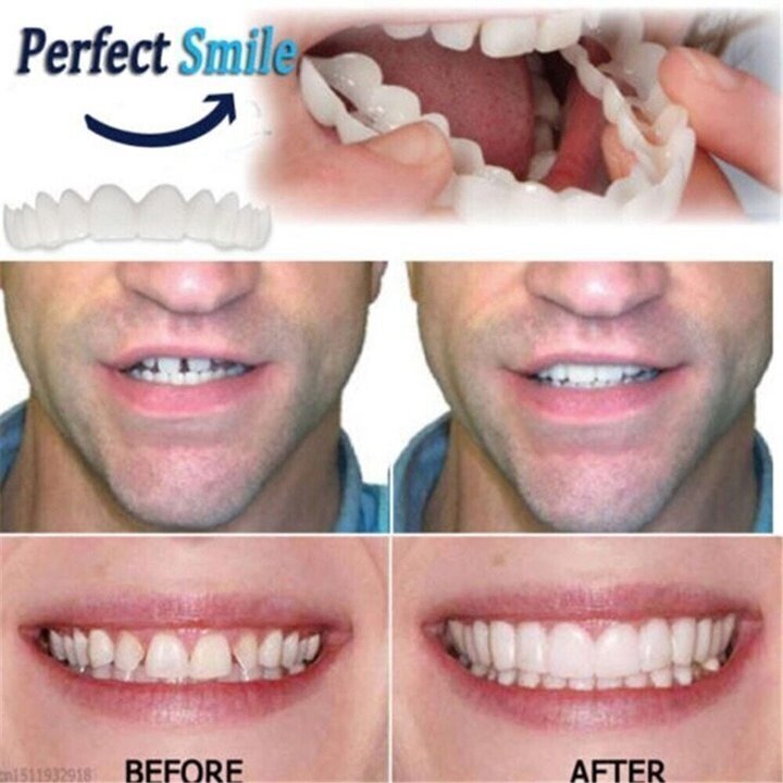💝 Last day discount-75%Off 💝 Latest 👨‍⚕ Adjustable Snap-On Dentures 😁
