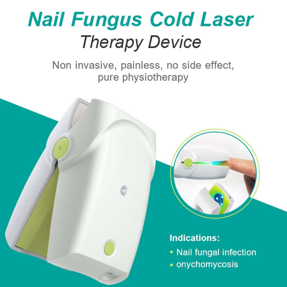 KTS Antifungal Laser Device for Onychomycosis White-KTS HEALTHCARE