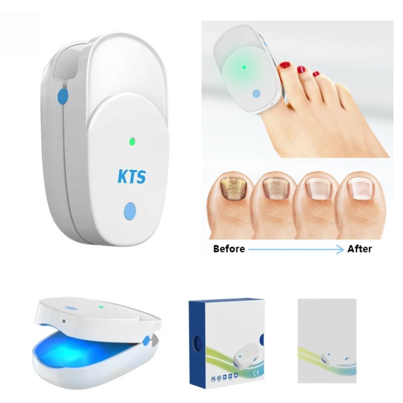KTS Antifungal Laser Device for Onychomycosis-KTS HEALTHCARE