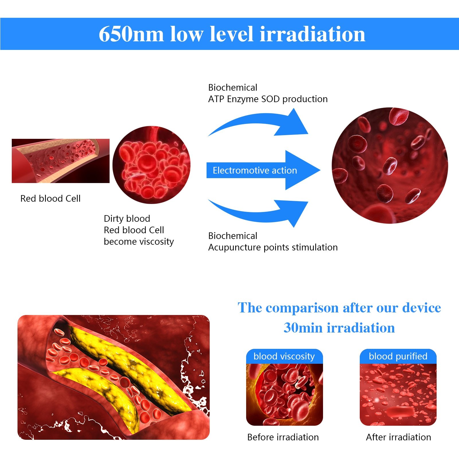 KTS 12 Holes Red Light Laser Wrist Watch for Diabetes Hypertension Sinusitis Heart Rate Semiconductor Laser Therapy Physiotherapy Home Use-KTS HEALTHCARE
