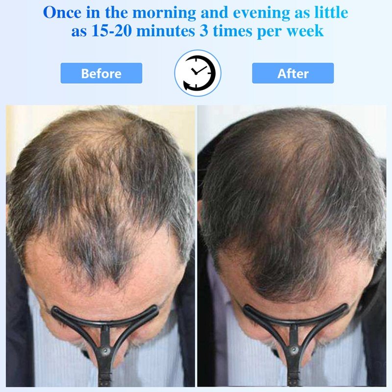 Laser Hair Growth Comb 650nm 18 Diodes Vibration Massager Comb Anti Hair Loss Therapy Infrared Red Light Hair Growth Machine-KTS HEALTHCARE