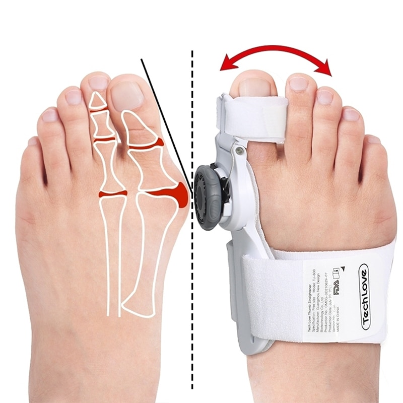 Adjustable Bunion Corrector for Women and Men Bunion Splint with Silicone Inner Pad for Bunion Relief-KTS HEALTHCARE
