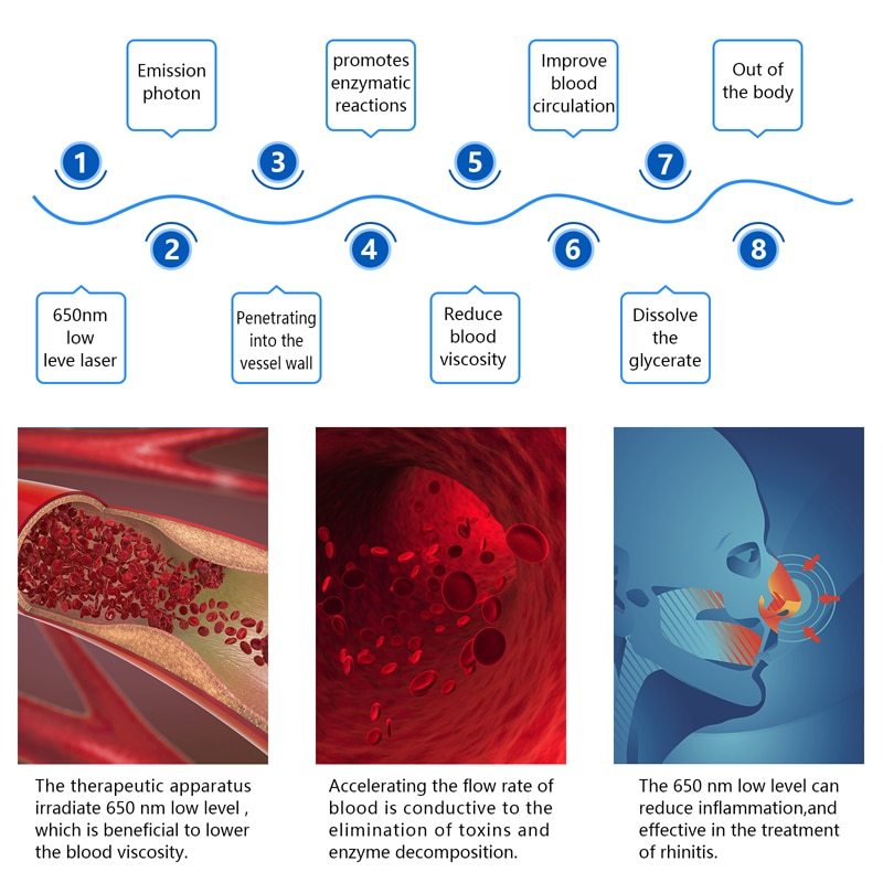 KTS 12 Holes Red Light Laser Wrist Watch for Diabetes Hypertension Sinusitis Heart Rate Semiconductor Laser Therapy Physiotherapy Home Use-KTS HEALTHCARE