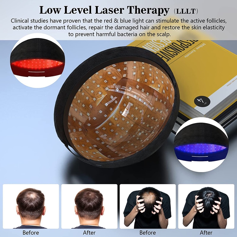 KTS Laser Hair Growth Cap for Hair Growth FDA Cleared Low Level Laser Therapy Hair Regrowth-KTS HEALTHCARE
