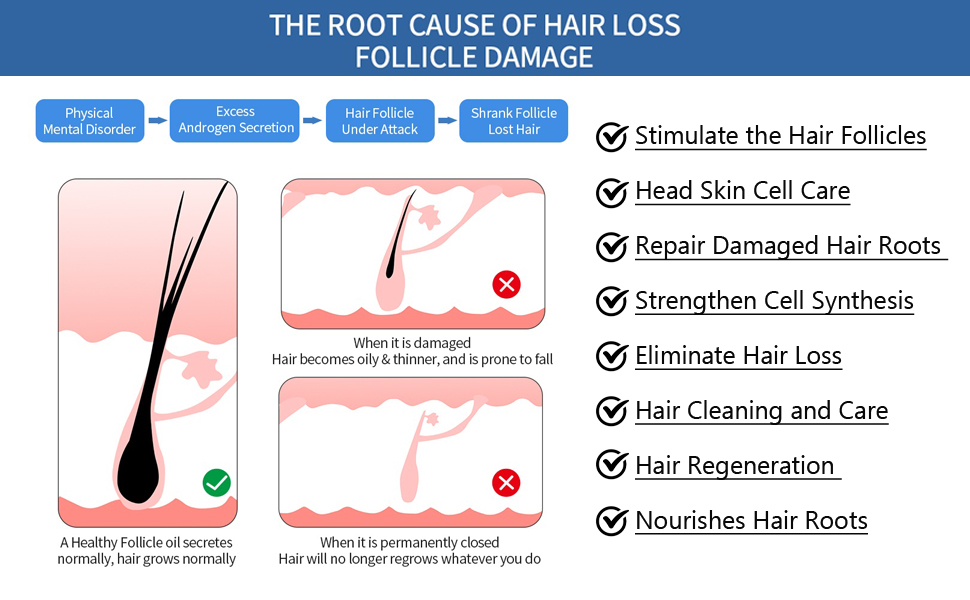 hair growth products