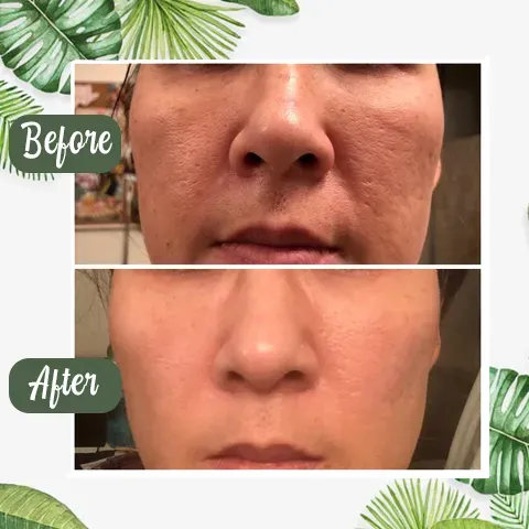 🔥BUY 1 GET 1 FREE🔥GREEN TEA DEEP CLEANSE MASK🍃