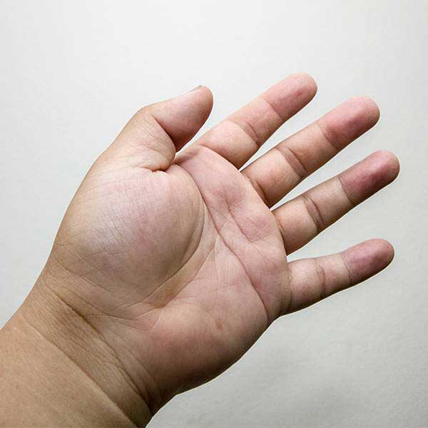 Help Relieve Poor Circulation and Swelling