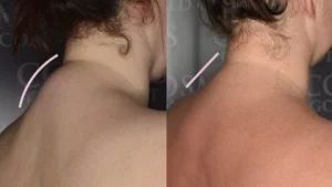 Click to view full screen LUMINEASE - Ultrasonic Lymphatic Soothing Instrument photo review