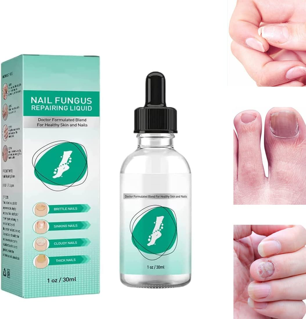 Kerassentials Toenail Treatment Oil