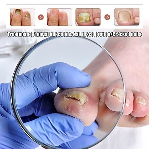 Kerassentials Toenail Treatment Oil