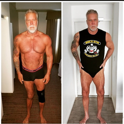 Kevin Nash Deformed Legs