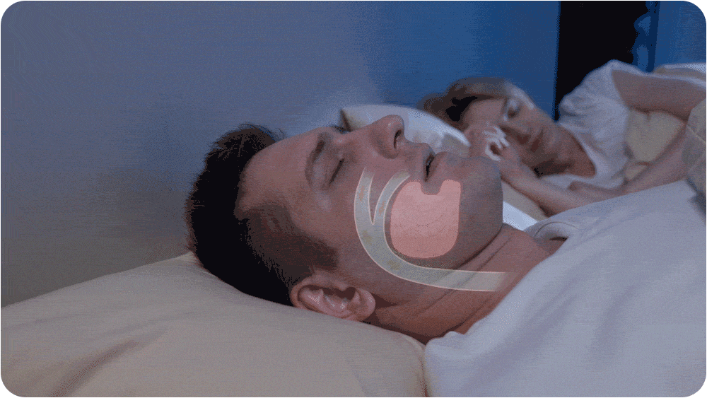 AlaskaTag - Airing: The first hoseless, maskless, micro-CPAP Anti Snoring 1 01