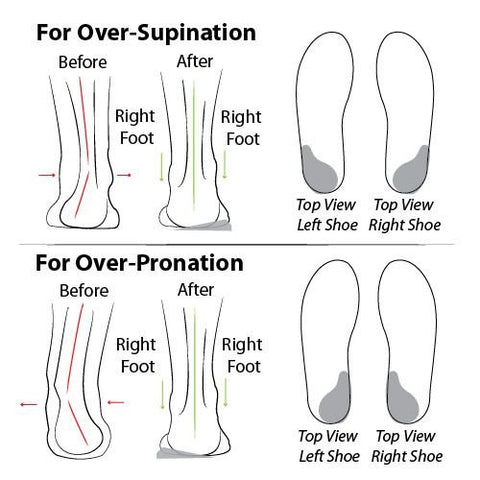 Women Orthopedic Slip-On Shoes