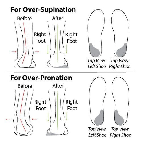 Onecomfy Outdoor Women Air Cushion Orthopedic Sneakers