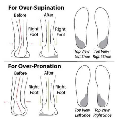 Women Premium Orthopedic Slip-on Shoes