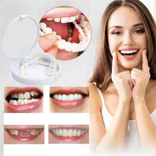 （Duty Free）Last day discount-(50%Off)- Adjustable snap-on dentures