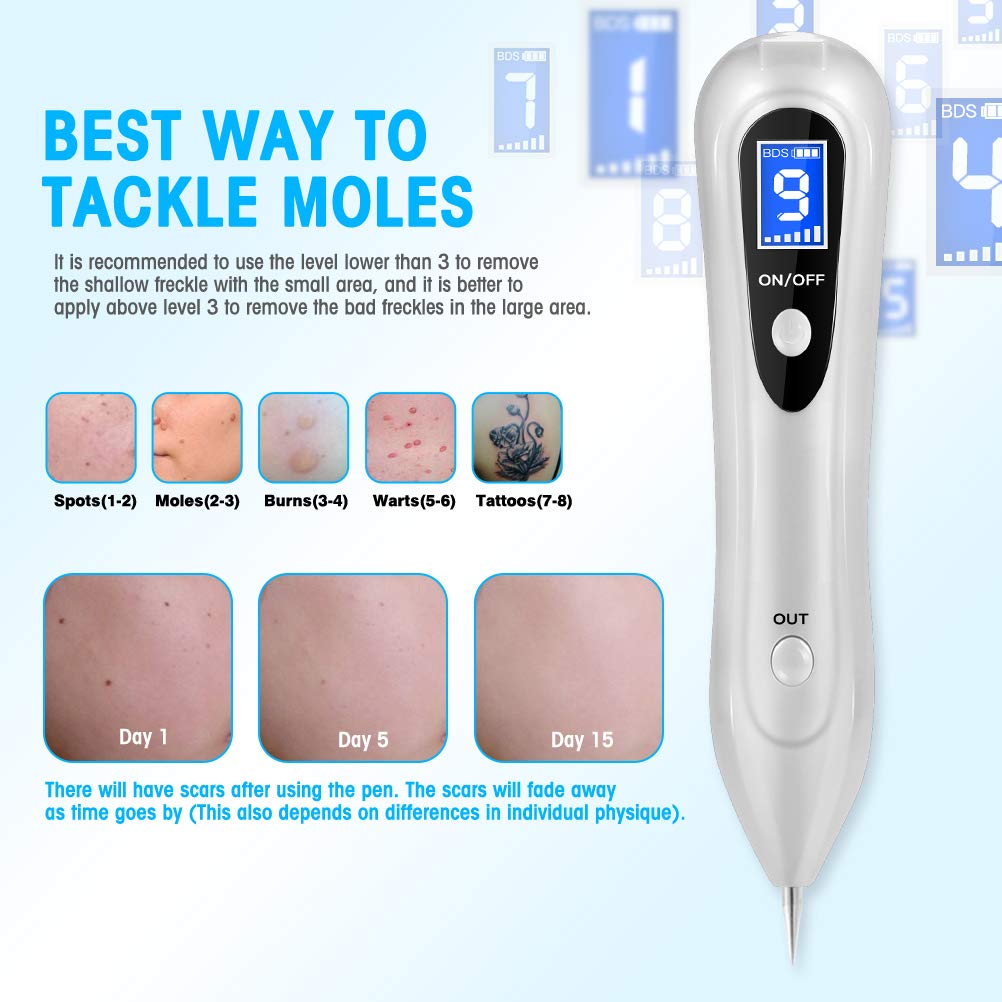 Mole Removal Warts Removal Mole Removal with 9 Strength Levels