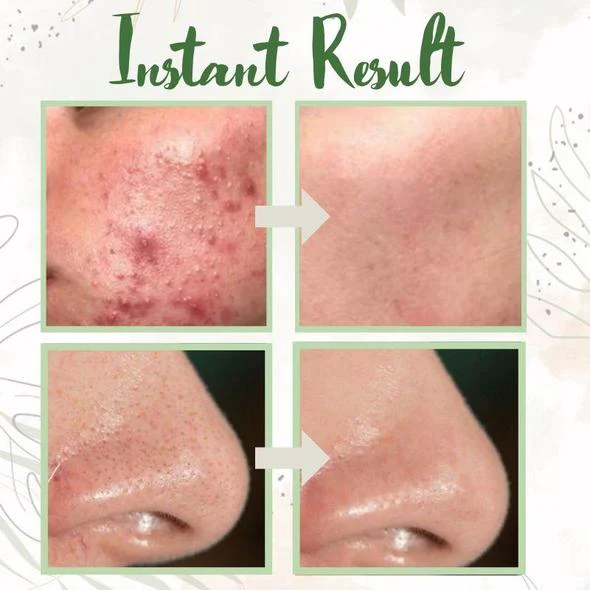 Final Sale - Green Tea Deep Cleanse Mask [Last Day!] Free Shipping