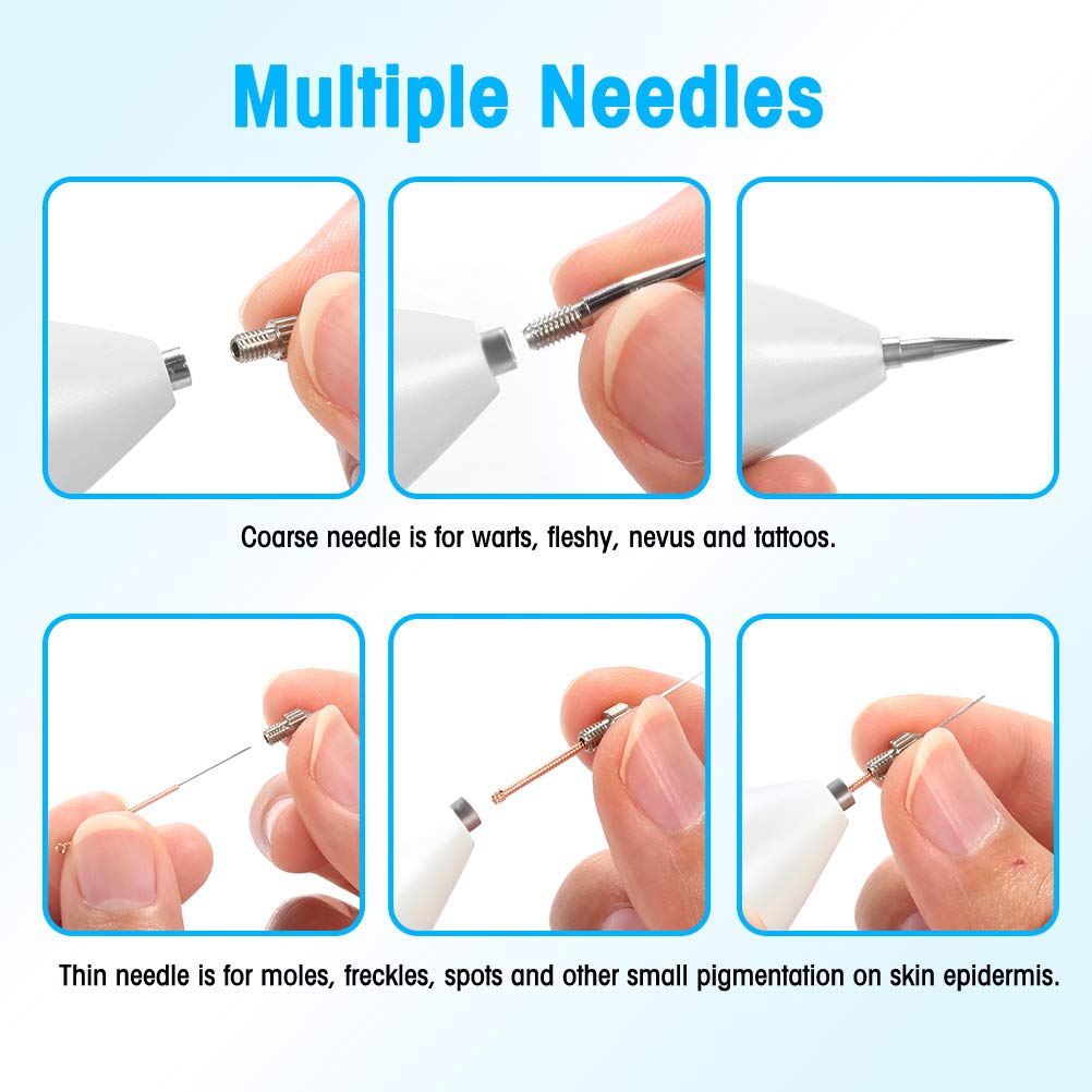 Mole Removal Warts Removal Mole Removal with 9 Strength Levels