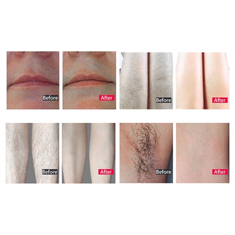 808nm Diode Laser Multi Wavelengths Hair Removal Machine Cooling Head Painless Laser Epilator Face Body Hair Removal