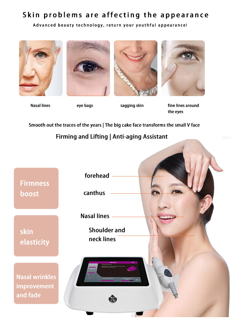 New Arrivals 2023 Portable Skin Tightening Rf Rf Machine Skin Lifting Skin Tightening Device For Face Lifting
