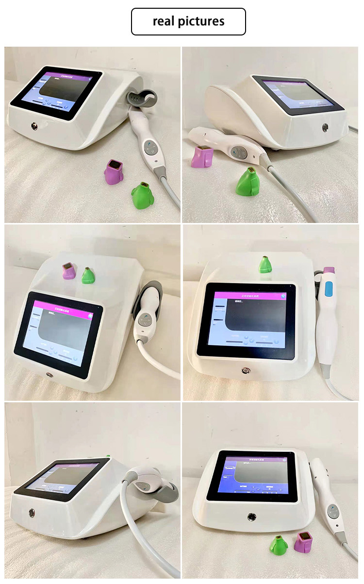 New Arrivals 2023 Portable Skin Tightening Rf Rf Machine Skin Lifting Skin Tightening Device For Face Lifting