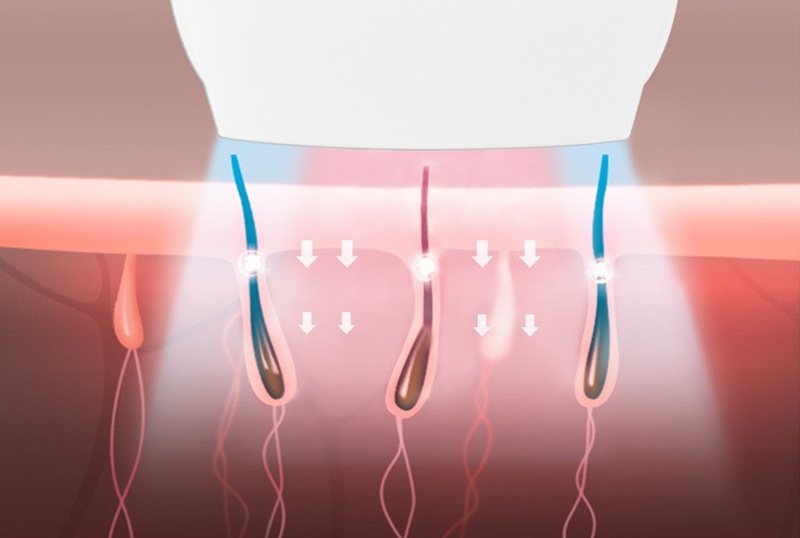 Multifunctional IPL Opt Nd Yag Laser Permanent Hair And Tattoo Removal Picosecond Laser Acne Removal Machine