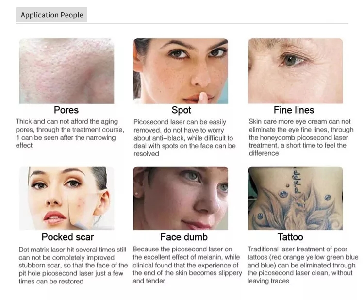 Professional Q Switch Nd Yag Portable Skin Whitening Acne Dark Spot Remover Tattoo Permanent Hair Removal Laser Machine