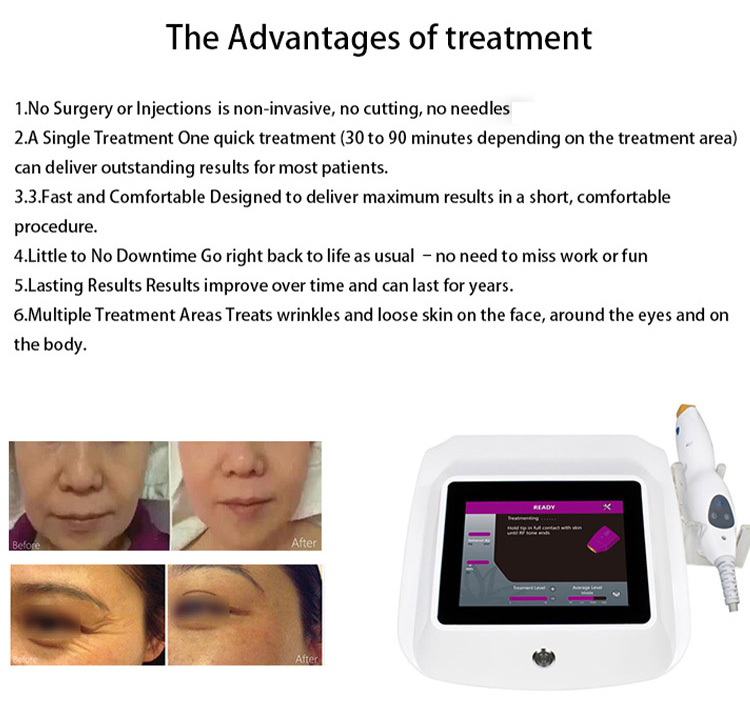 New Arrivals 2023 Portable Skin Tightening Rf Rf Machine Skin Lifting Skin Tightening Device For Face Lifting