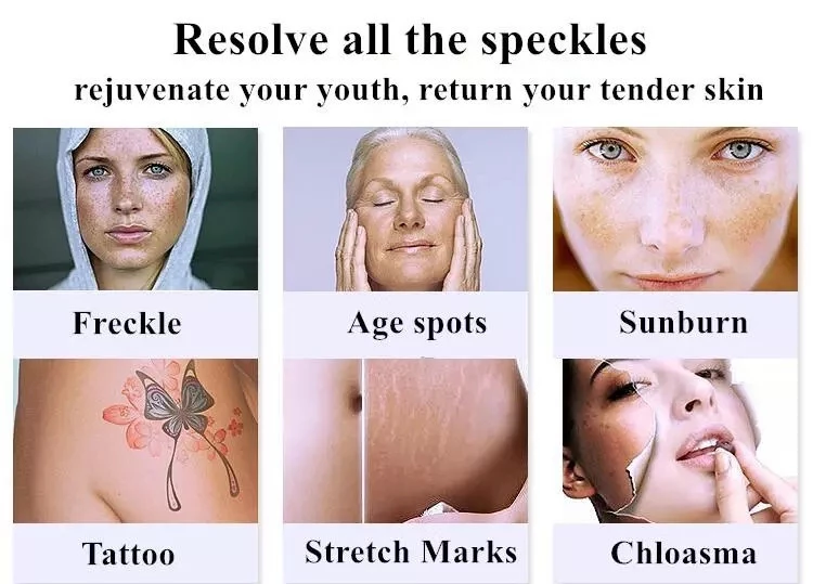 Multifunctional IPL Opt Nd Yag Laser Permanent Hair And Tattoo Removal Picosecond Laser Acne Removal Machine