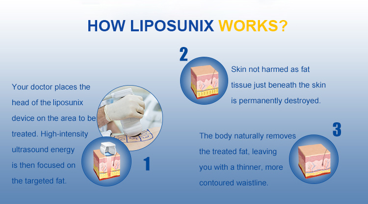 Portable Ultrasound Body Cellulite Removal Machine Body Shaping Liposonic Slimming Machine