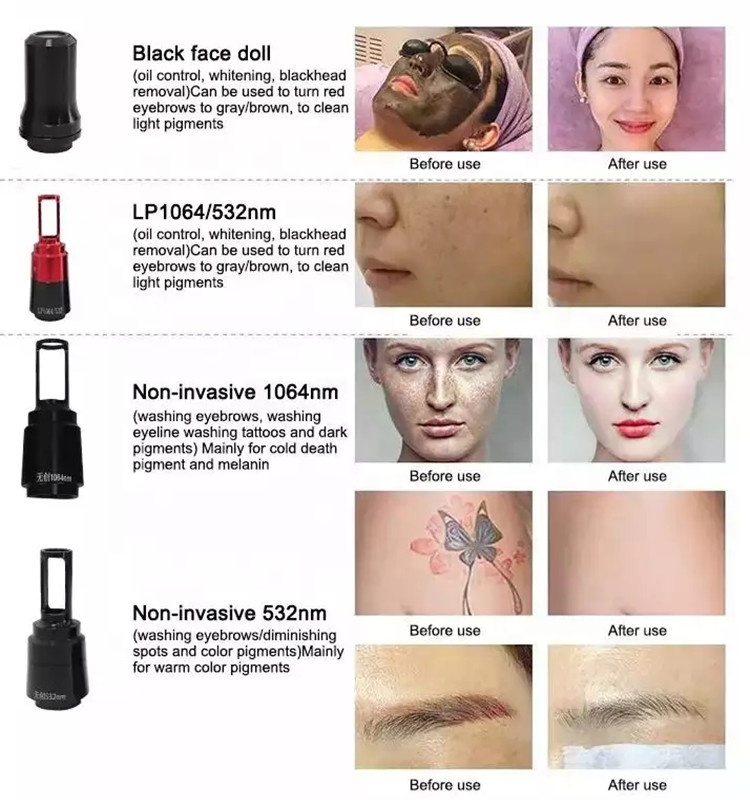 2023 New Diode Laser 810nm Hair Removal Picosecond Laser Tattoo Removal Black Doll Carbon Peeling Laser Machine