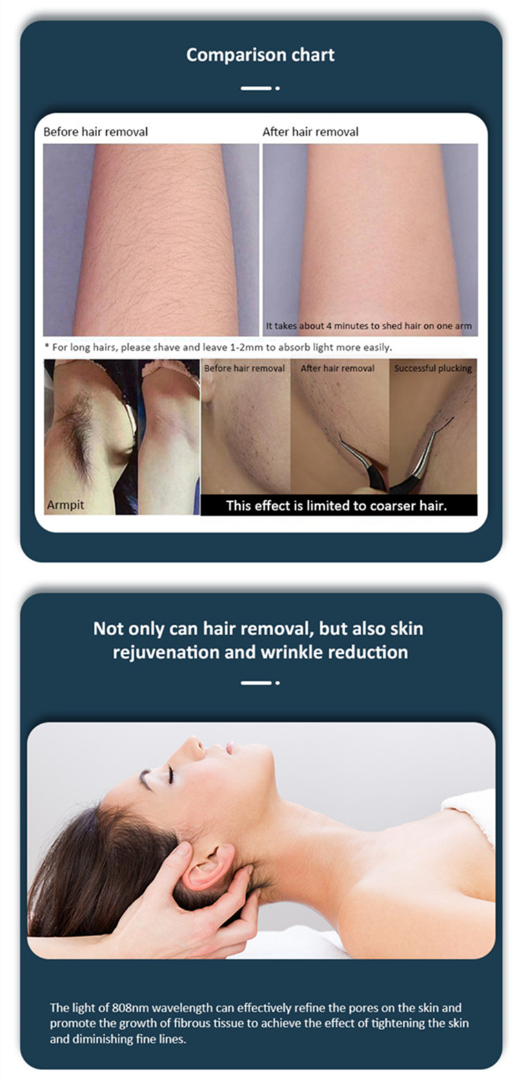 2023 New Diode Laser 810nm Hair Removal Picosecond Laser Tattoo Removal Black Doll Carbon Peeling Laser Machine