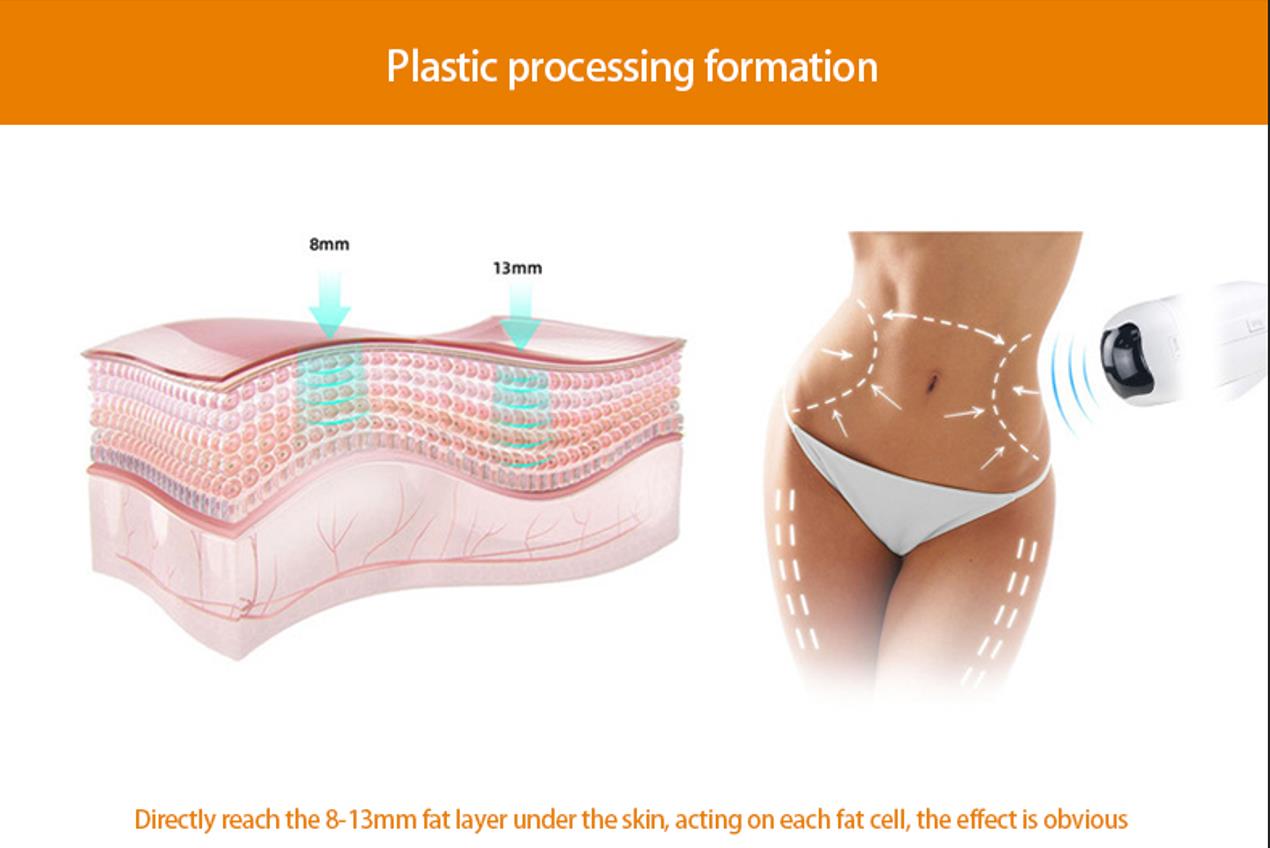 body slimming machine cellulite removal machine